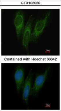 Anti-DNAJC1 antibody [C1C3] used in ICC/IF. GTX103858