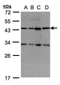 Anti-DNAJC17 antibody [N1C2] used in Western blot. GTX104456