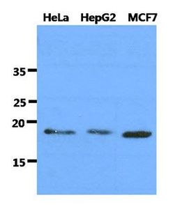 Anti-DNAL1 antibody [AT29E4] used in Western blot. GTX53709