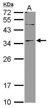Anti-DNASE2B antibody [N1C3] used in Western blot. GTX119205
