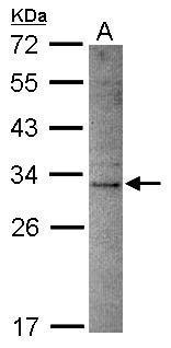 Anti-DNASE2B antibody [N2C3] used in Western blot. GTX119206