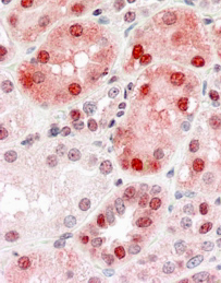 Anti-DNMT1 antibody, Internal used in IHC (Formalin-fixed paraffin-embedded sections). GTX88801