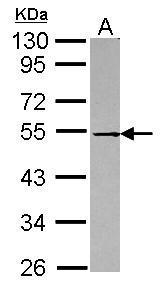 Anti-DOK1 antibody [N1C1] used in Western blot. GTX101610