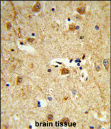 Anti-DOLK antibody, Internal used in IHC (Formalin-fixed paraffin-embedded sections). GTX80992