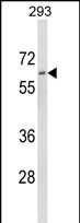 Anti-DOLK antibody, Internal used in Western blot. GTX80992
