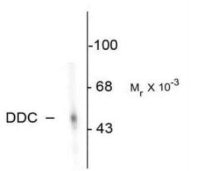 Anti-DOPA Decarboxylase antibody used in Western blot. GTX30448