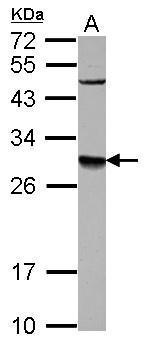 Anti-DPM1 antibody [N1C2] used in Western blot. GTX106196