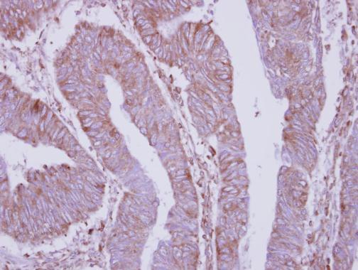 Anti-DPY19L4 antibody [C2C3], C-term used in IHC (Formalin-fixed paraffin-embedded sections). GTX106885