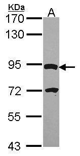 Anti-DPY19L4 antibody [C2C3], C-term used in Western blot. GTX106885