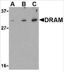 Anti-DRAM antibody used in Western blot. GTX85483