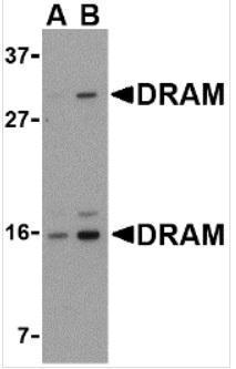 Anti-DRAM antibody used in Western blot. GTX85484