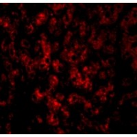 Anti-DRAM antibody used in ICC/IF. GTX85484