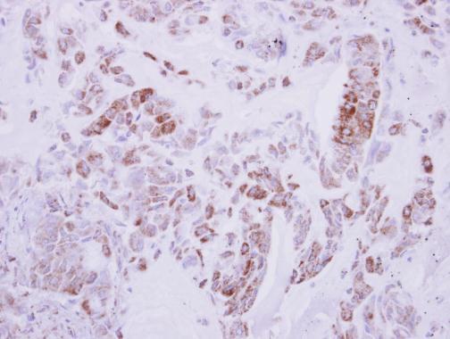 Anti-DRG2 antibody used in IHC (Formalin-fixed paraffin-embedded sections). GTX118599