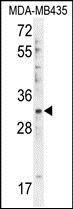 Anti-DTWD1 antibody used in Western blot. GTX53546