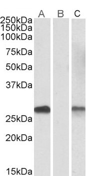Anti-DYDC1 (aa142-154) antibody, Internal used in Western blot. GTX88143