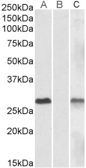 Anti-DYDC1 antibody, Internal used in Western blot. GTX88205