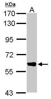 Anti-DYNC1LI1 antibody used in Western blot. GTX120114