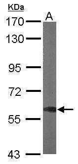 Anti-DYNC1LI1 antibody used in Western blot. GTX120114