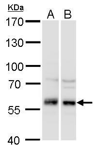 Anti-DYNC1LI1 antibody used in Western blot. GTX120806