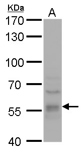 Anti-DYNC1LI1 antibody used in Western blot. GTX120806