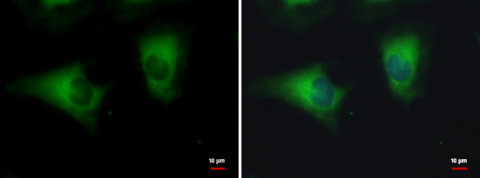 Anti-DYNC1LI1 antibody used in ICC/IF. GTX120806