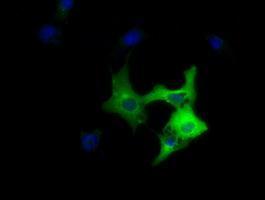Anti-DYNC1LI1 antibody [1B9] used in ICC/IF. GTX84596