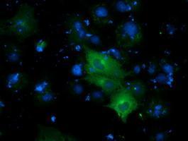 Anti-DYNC1LI1 antibody [1C2] used in ICC/IF. GTX84593