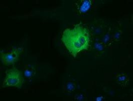 Anti-DYNC1LI1 antibody [1C5] used in ICC/IF. GTX84598