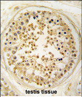 Anti-EARS2 antibody, C-term used in IHC (Formalin-fixed paraffin-embedded sections). GTX81386