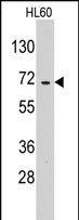 Anti-EARS2 antibody, C-term used in Western blot. GTX81386