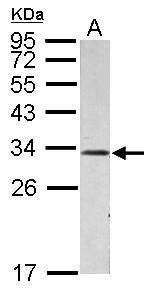 Anti-EB3 antibody used in Western blot. GTX115652