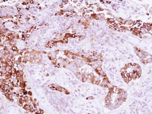 Anti-EB3 antibody used in IHC (Formalin-fixed paraffin-embedded sections). GTX115652