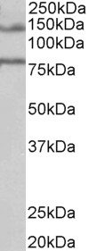 Anti-EBPL41L5 antibody, Internal used in Western blot. GTX88887