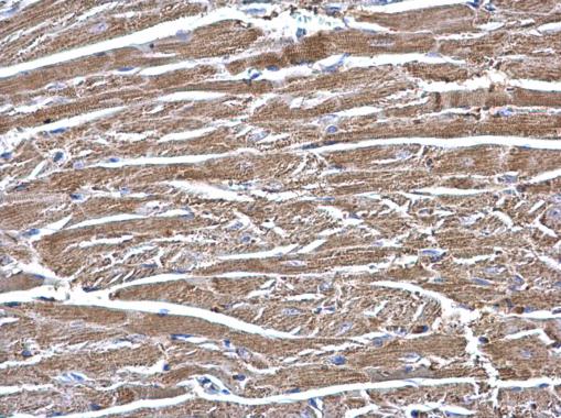 Anti-ECHS1 antibody used in IHC (Formalin-fixed paraffin-embedded sections). GTX114375