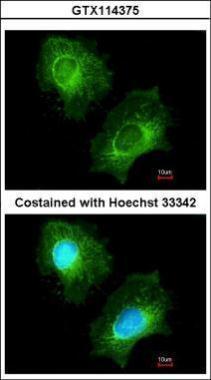 Anti-ECHS1 antibody used in ICC/IF. GTX114375