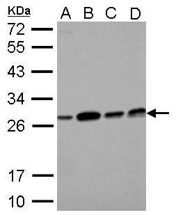 Anti-ECHS1 antibody used in Western blot. GTX114375
