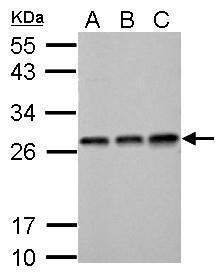 Anti-ECHS1 antibody used in Western blot. GTX114375