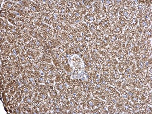Anti-ECHS1 antibody used in IHC (Formalin-fixed paraffin-embedded sections). GTX114375
