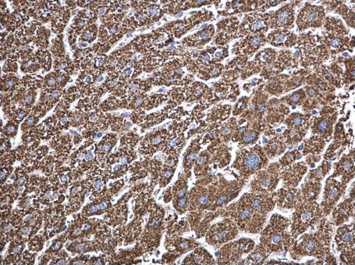Anti-ECHS1 antibody [N1C2] used in IHC (Formalin-fixed paraffin-embedded sections). GTX114376