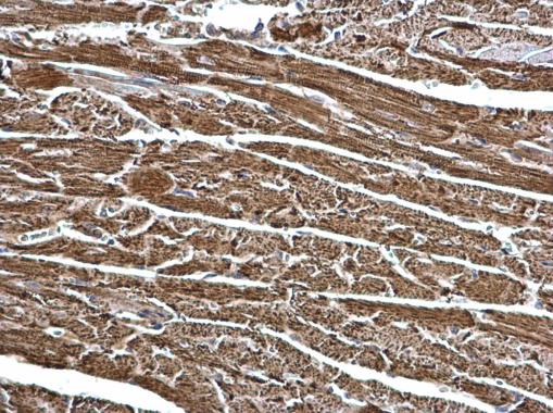 Anti-ECHS1 antibody [N1C2] used in IHC (Formalin-fixed paraffin-embedded sections). GTX114376
