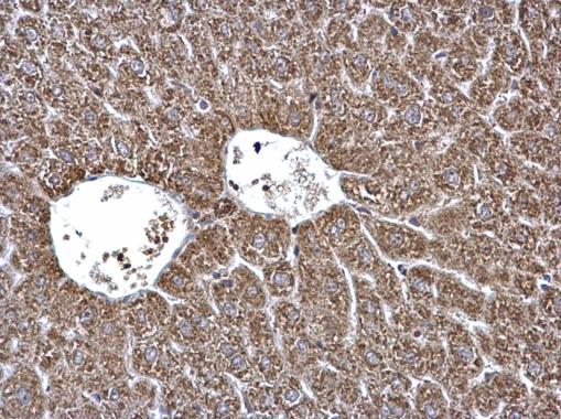 Anti-ECHS1 antibody [N1C2] used in IHC (Formalin-fixed paraffin-embedded sections). GTX114376