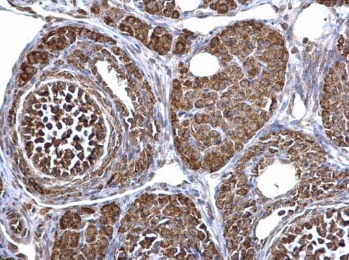 Anti-ECHS1 antibody [N1C2] used in IHC (Formalin-fixed paraffin-embedded sections). GTX114376