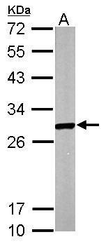 Anti-ECHS1 antibody [N1C2] used in Western blot. GTX114376