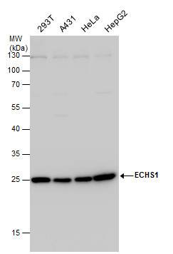 Anti-ECHS1 antibody [N1C2] used in Western blot. GTX114376