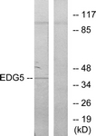 Anti-EDG5 antibody used in Western blot. GTX87937