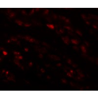 Anti-EFCAB4B antibody used in ICC/IF. GTX85142