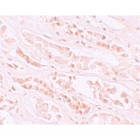 Anti-EFCAB4B antibody used in Immunohistochemistry. GTX85142