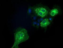 Anti-EFNA2 antibody [1E12] used in ICC/IF. GTX84586