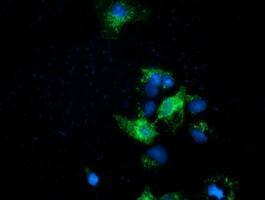Anti-EFNA2 antibody [2B7] used in ICC/IF. GTX84588