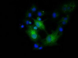 Anti-EFNA2 antibody [3E1] used in ICC/IF. GTX84585